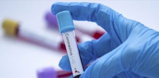 За последните 24 часа потврдени нови 53 случаи со КОВИД-19 и регистрирани 25 излекувани пациенти