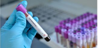 Валандовчанец позитивен на КОВИД-19, бил во државен карантин и се лекува во Битола – нови 28 позитивни во земјава