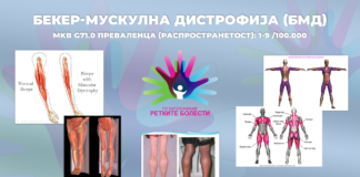 Во Струмица конференција како до поголема свест и поддршка на лицата со мускулна дистрофија Душен и Бекер